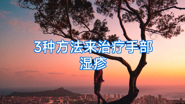 3种方法来治疗手部湿疹
