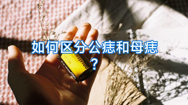 如何区分公痣和母痣?