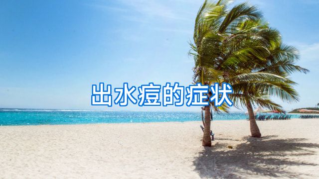 出水痘的症状